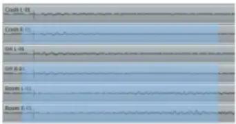 Crash L-01 Crash R-01 OH L-01 OH R-01 Room 1-01 Room 2-01 mmHg
