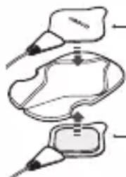OMRON Total Power + Heat PM800 - STORING THE PADS ON THE PAD HOLDER - 1
