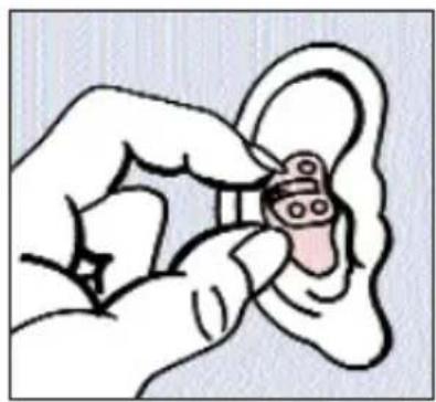 SIEMENS Intuis ITE - Inserting and removing your custom hearing instruments - 1