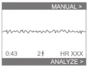 MANUAL > 0:43 2# HR XXX ANALYZE >