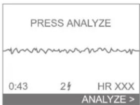 PRESS ANALYZE 0:43 2# HR XXX ANALYZE >