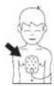 PHILIPS HeartStart FR2+ M3861A - symbol description - 2