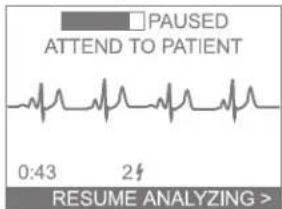 PAUSED ATTEND TO PATIENT 0:43 2# RESUME ANALYZING >