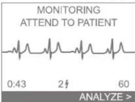 MONITORING ATTEND TO PATIENT 0:43 2 60 ANALYZE >