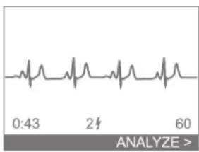 PHILIPS HeartStart FR2+ M3861A - Using advanced mode features - 3