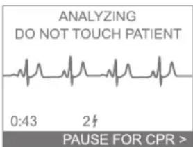 ANALYZING DO NOT TOUCH PATIENT 0:43 2# PAUSE FOR CPR >