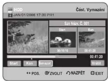 HDD JAN/01/2006 17:30 PR1 Část. Vymazání Szt. Nizv. Č. 001 Start Kon 00:19:10 00:41:20 00:41:20 Start Kon Smazat Vrátúí POS. ZVOLIT NAZPÉT EXIT
