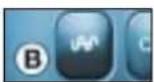 PEUGEOT 406 C (2002) - Automatic storing of FM stations in the memory (autostore) - 1