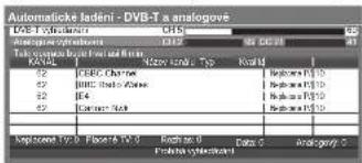 Automatische ledeni - DVB-T analogové L02-B1000000000000000000000000000000000000000000000000000000000000000000000000000000000000000000000 L12-227-236-237-238-239-240-241-242-243-244-245-246-247-248-249-250-251-252-253-254-255-256-257-258-259-260-261-262-263-264-265-266-267-268-269-270-271-272-273-274-275-276-277-278-279-280-281-282-283-284-285-286-287-288-289-290-291-292-293-294-295-296-297-298-299-300-301-302-303-304-305-306-307-308-309-310-311-312-313-314-315-316-317-318-319-320-321-322-323-324-325-326-327-328-329-330-331-332-333-334-335-336-337-338-339-340-341-342-343-344-345-346-347-348-349-350-351-352-353-354-355-356-357-358-359-360-361-362-363-364-365-366-367-368-369-370-371-372-373-374-375-376-377-378-379-380-381-382-383-384-385-386-387-388-389-390-391-392-393-394-395-396-397-398-399-400