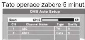 PANASONIC DMR-EX645 - KROK 2 Nastavení vstupního kanálu a poměru stran obrazu televizoru - 5