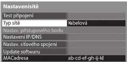 Nastavenísítě Test připojení Typ sitě Kabelová Nastav. přístupového bodu Nastavení IP/DNS Nastav. síťového spojení Update softwaru MACadresa ab-cd-ef-gh-ij-kl