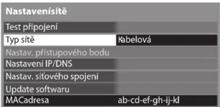 Nastavenísítě Test připojení Typ sítě Kábelová Nastav. přístupového bodu Nastavení IP/DNS Nastav. síťového spojení Update softwaru MACadresa ab-cd-ef-gh-ij-kl
