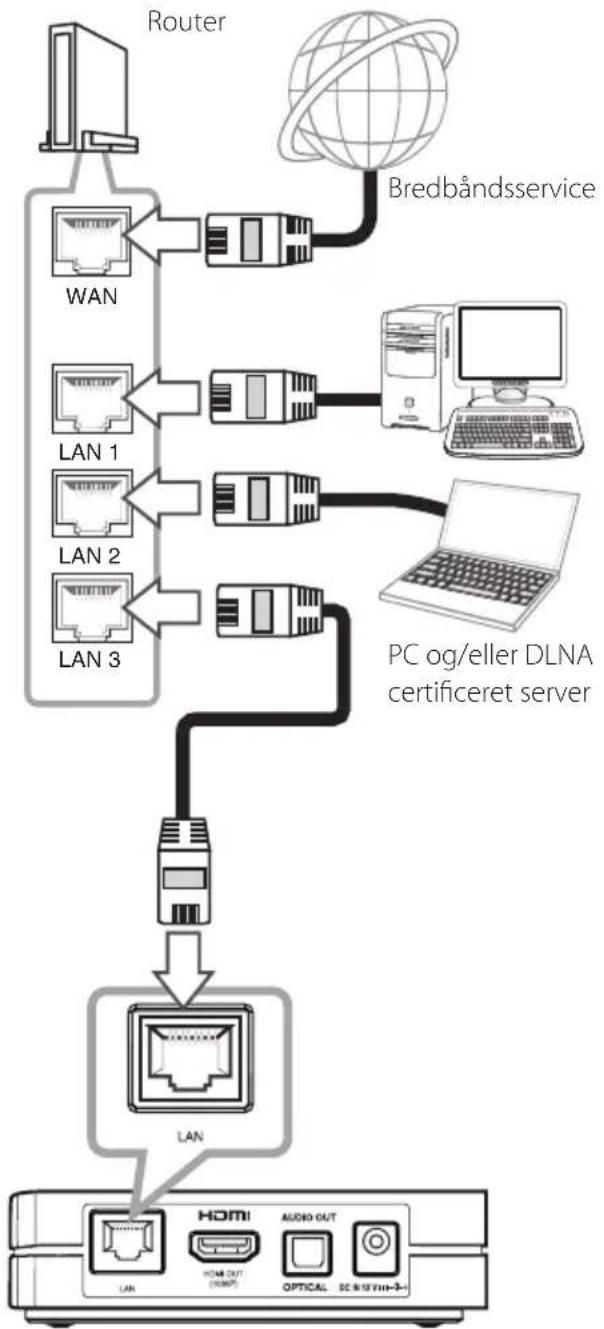 LG SP520N - Bemaerk - 1