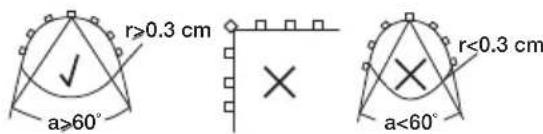 r≥0.3 cm × r<0.3 cm a≥60° a<60°
