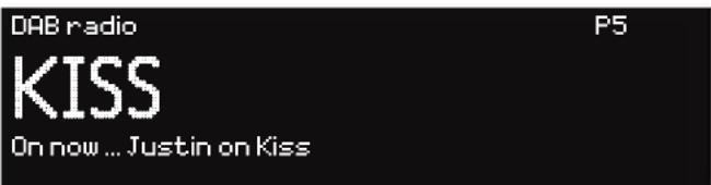 DAB radio KISS On now ... Justin on Kiss P5