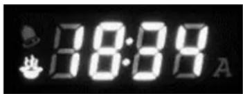 18:38 A