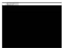 AVer AVerVision VP-1HD - Visor - 1