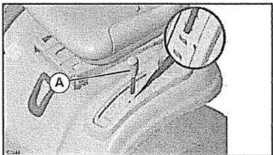 Medical diagram showing anatomical structures with labeled point A and magnified detail view
