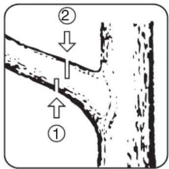 Diagram showing two labeled sections (① and ②) with arrows indicating flow or movement between structures, likely illustrating a geological or engineering process.