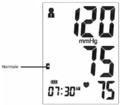 120 mmHg 75 Normal 07:30 AM • 75