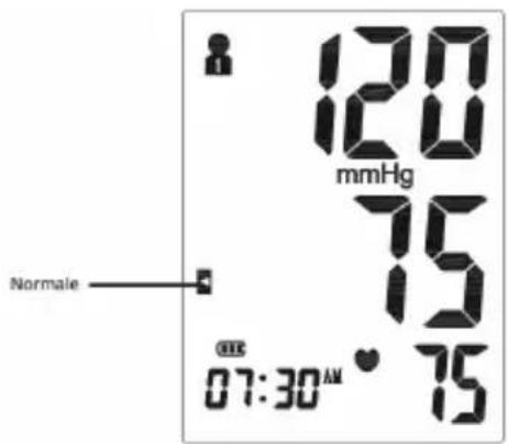 120 mmHg 75 Normal 75 07:30 AM • 75