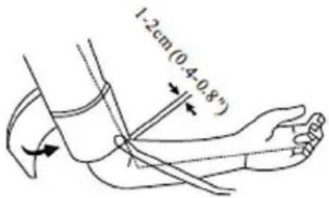 1.2cm(0.4-0.8°)