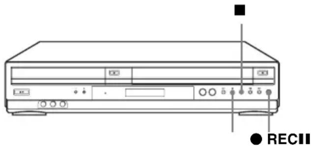 SONY SLV-D983PD - Vorbereitungen - 1