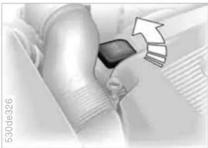 Medical procedure image showing hand placement with arrow indicating direction (no text or symbols)