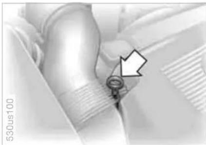 Medical procedure image showing a hand holding a catheter with an arrow pointing to the catheter (no text or symbols present)