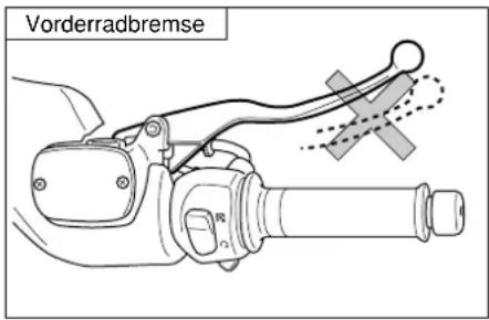 Vorderradbremse
