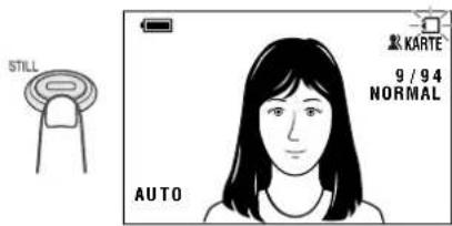 STILL KARTE 9 / 94 NORMAL AUTO