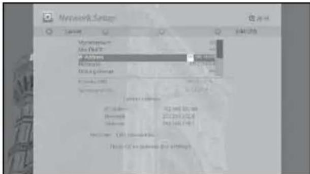 Vu+ Ultimo - DHCP verwenden - 2