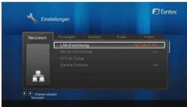Einstellungen Netzwerk Gesamtiges Systeme Audio Video LAN-Einrichtung 152.108.10.173 WLAN-Einrichtung Aus PPFoE Setup Sample Process Aus Orange category Netzwerk