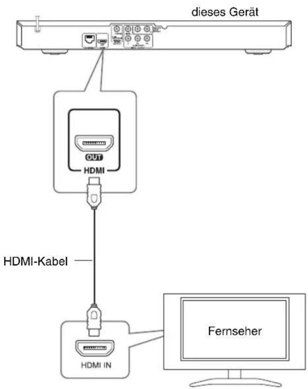 dieses Gerät HDMI HDMI-Kabel HDMI IN Fernseher