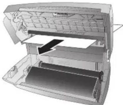 PHILIPS Magic 5 PPF725 - Device can Close with a Snap! - 1