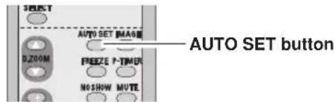 AUTO SET button AUTO SET IMAGE D:200M FREEZE P-TIMER NOSHOW MUTE