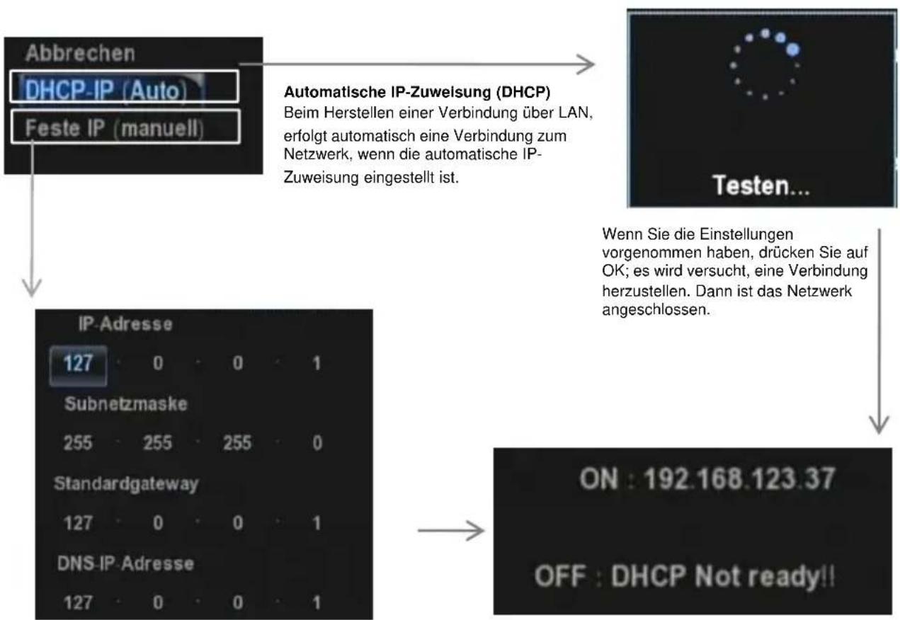 Mvix MXPVR-500 - 5) Netzwerk-Einstellungen - 3