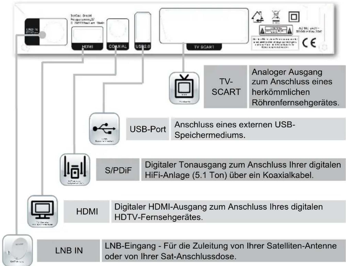 SetOne EasyOne HX 40 HD - Übersicht der Anschussmöglichkeiten - 1