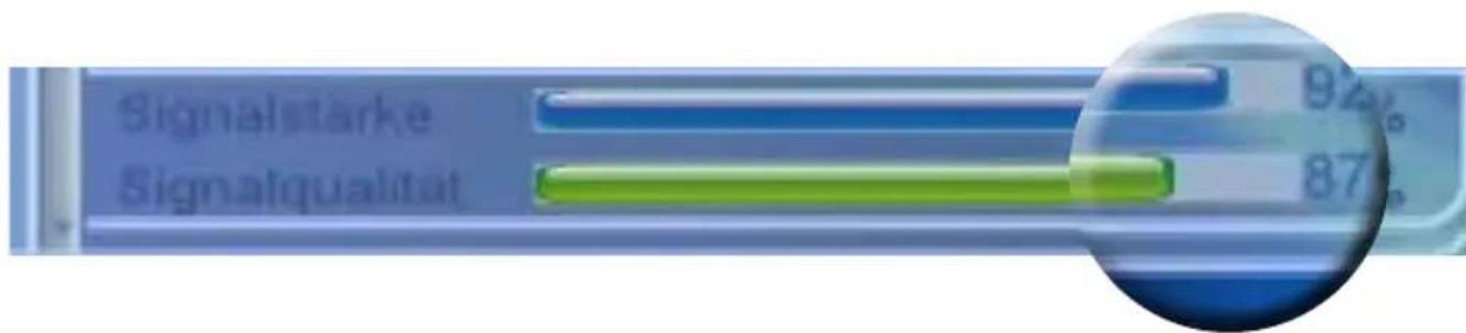 SetOne EasyOne HX 40 HD - Bedienung des Gerätes - 1