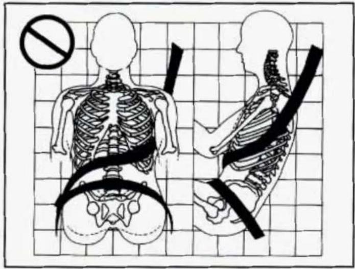Medical illustration showing human skeletal anatomy with a no-smoking symbol and a cross-section of the lower torso.