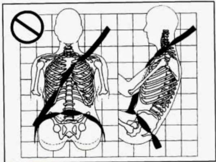 Medical illustration showing human skeletal anatomy with a no-smoking symbol and a cross-section of the spine, likely for teaching or examination.