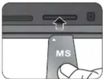 MS