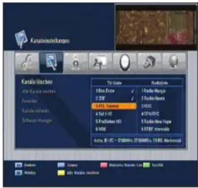 Kanaleinstellungen Kanale Instellen Aflp Espane Inalien Fusioner Kanala vorheren Schwasser Manager Ttl. Uste 100x 300x 200x 300x 400x 500x 600x Radio Merys Radio Herv 300G 400V/VO 500Hz Topo 600Hz Immuno Aura: W-UC - 300Hz, 27 MHz, 1 MHz, Monocral