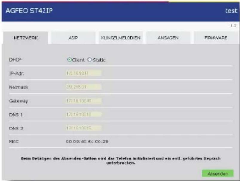AGFEO ST 42 IP AB - Achtung: - 1