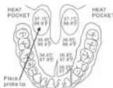 Lumiscope L2214 - Rectal Use - 1