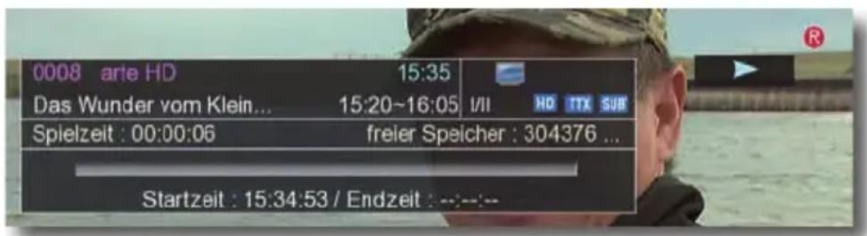 Telestar TD 2530 HD - Direkte Aufnahme - 1