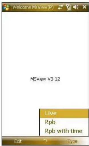 MSView V3.12 Live Rpb Rpb with time Exit Type