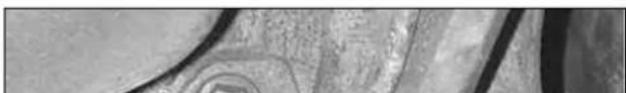 Close-up of textured surface with indistinct circular patterns (no readable text or symbols)
