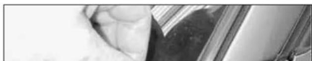Close-up of a textured surface with dark and light patches, possibly fabric or material (no visible text or symbols)