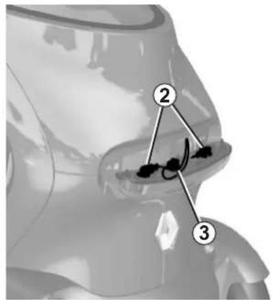 Medical diagram showing anatomical structures with numbered labels pointing to specific regions of interest.